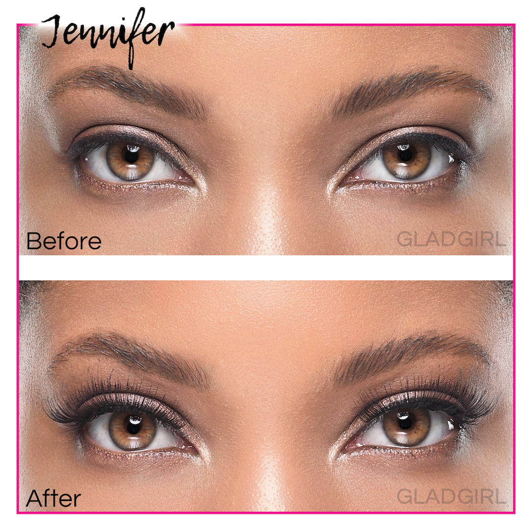 products/A1172-3-Jennifer-Before-After.jpg