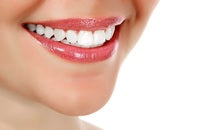 Do-It-Yourself Teeth Whiteners﻿