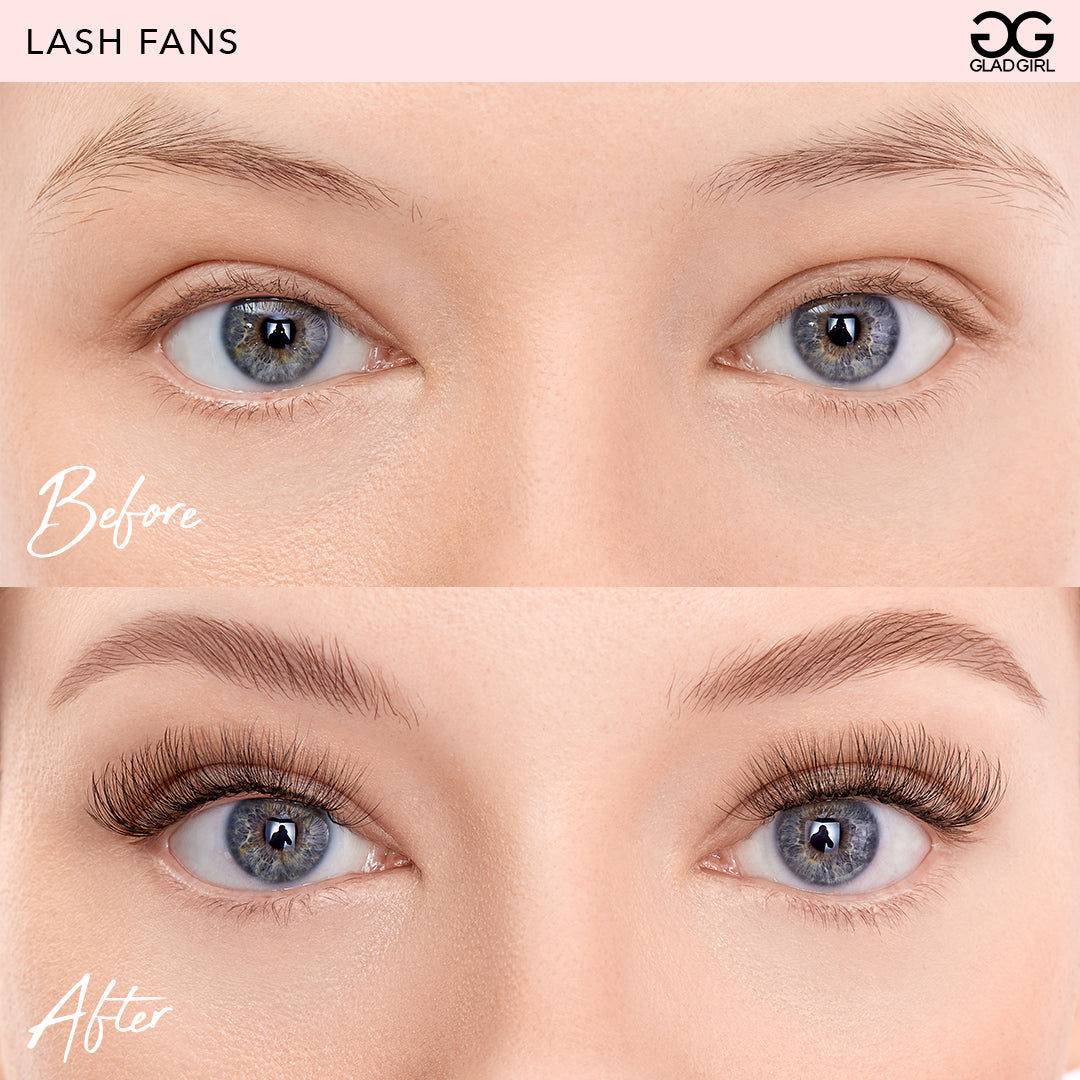 Product image: 5