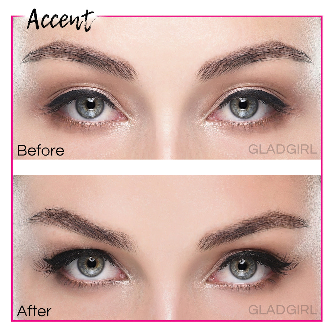 products/A1141-3-Accent-Before-After.jpg