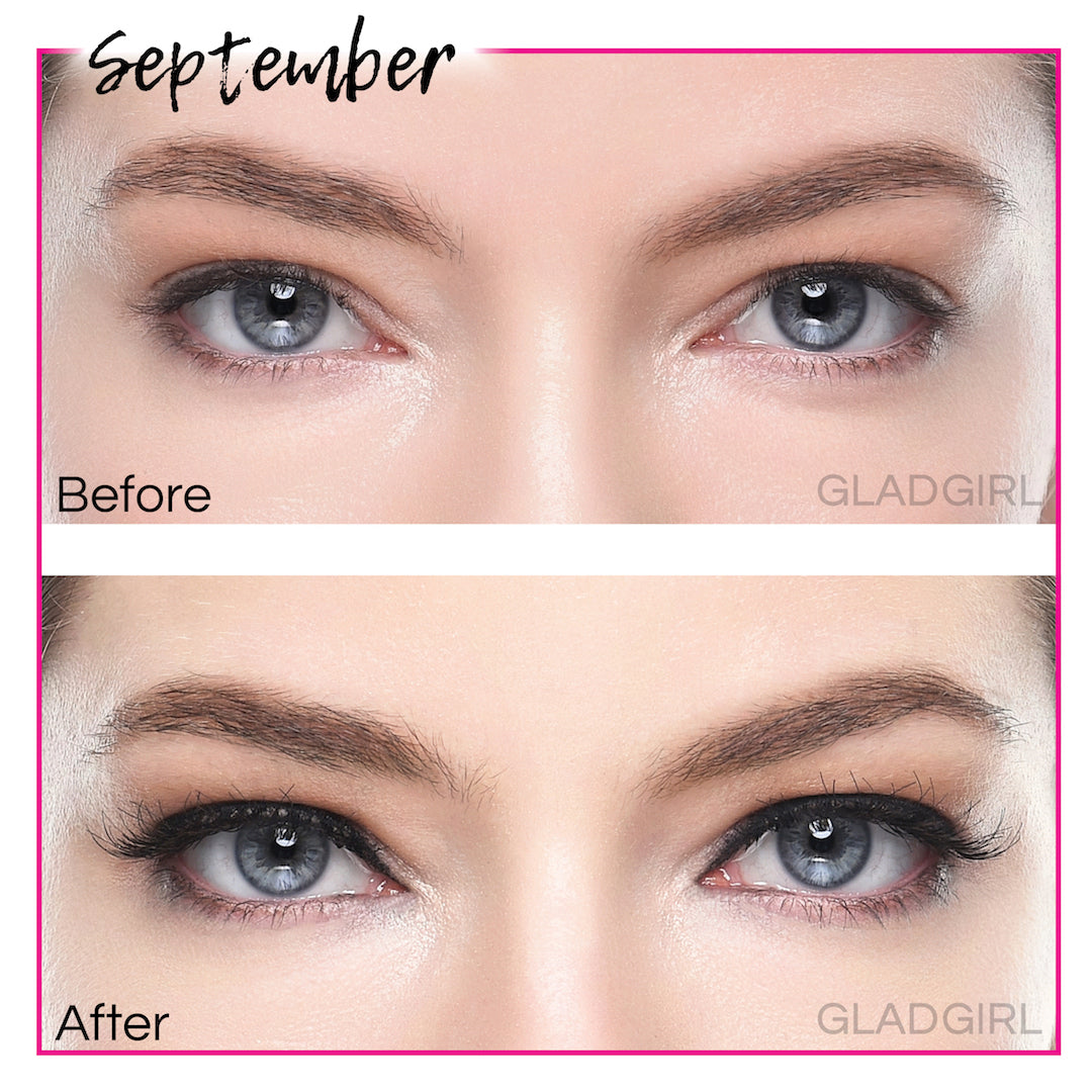 products/A1158-3-September-Before-After.jpg